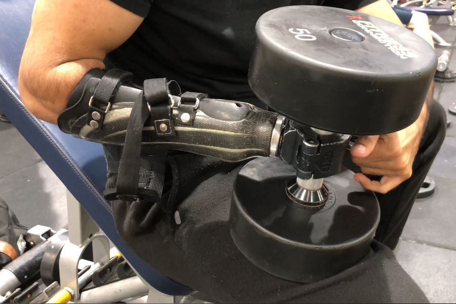 Weightlifting with an Upper Limb Prosthesis